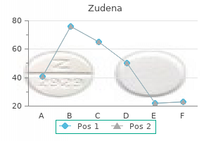 buy zudena 100 mg with mastercard